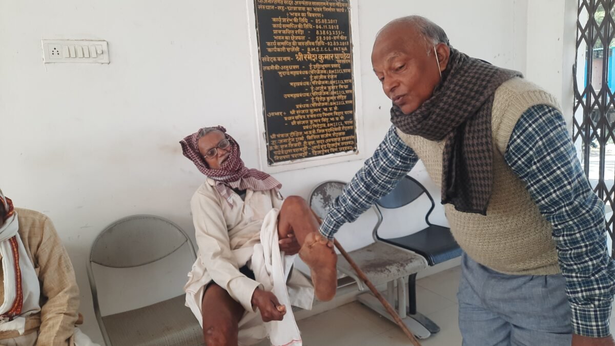 सासाराम : जागरूकता की वजह से कुष्ठ पीड़ित मरीज इलाज के लिए पहुँच रहे अस्पताल: एसीएमओ